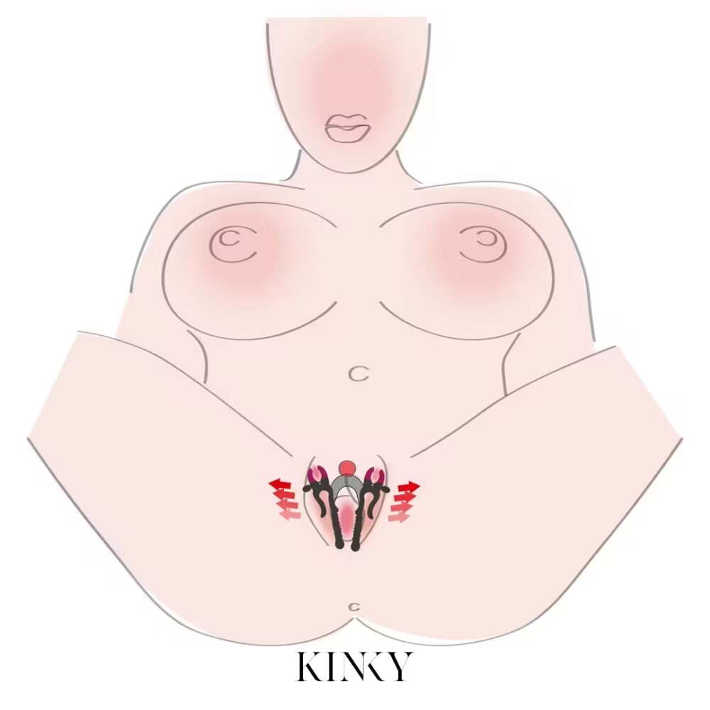 štipaljke za vaginu