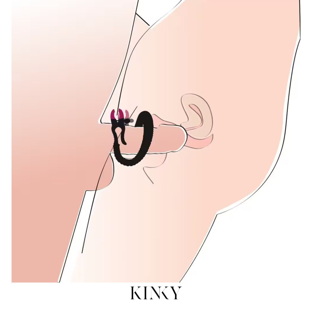 štipaljke za vaginu